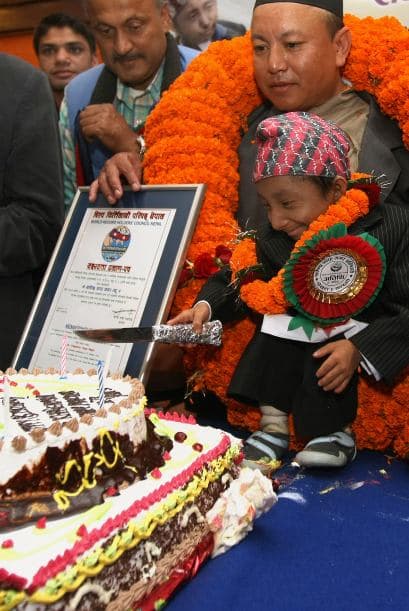 Su padre dijo desconocer por qué nunca creció más, puesto que un hermano menor de Magar tiene la estatura normal de un chico de 13 años.