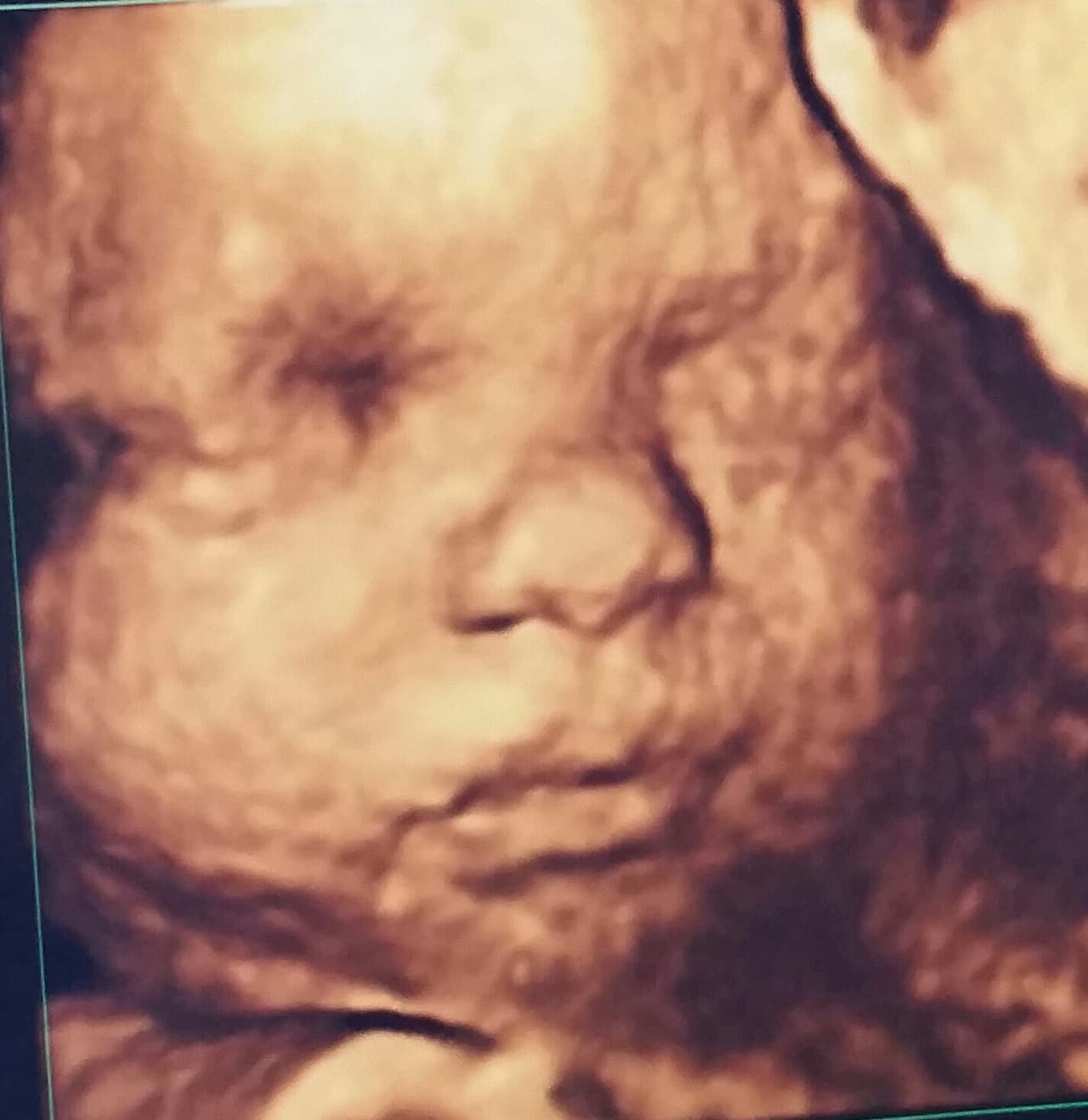 Gredmarie compartió el sonograma 4D de su adorada baby Kamilia