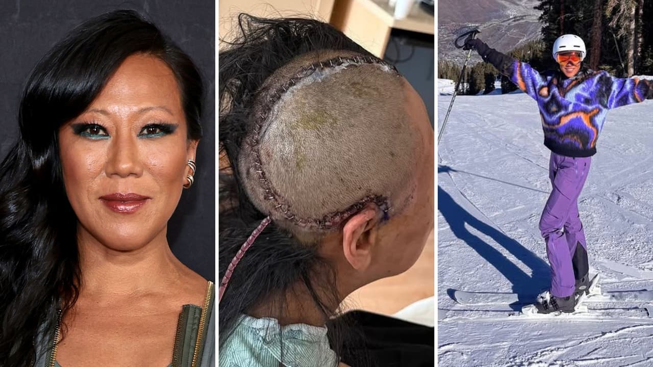 Muere estrella de ‘Bling Empire: New York’ tras someterse a cirugía cerebral: sufrió grave accidente