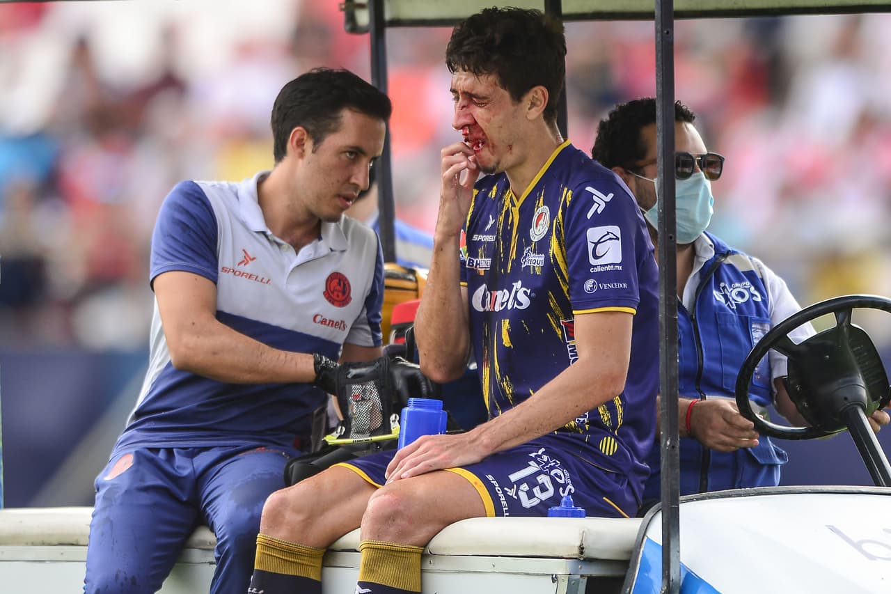 El jugador sufrió una ruptura de nariz.