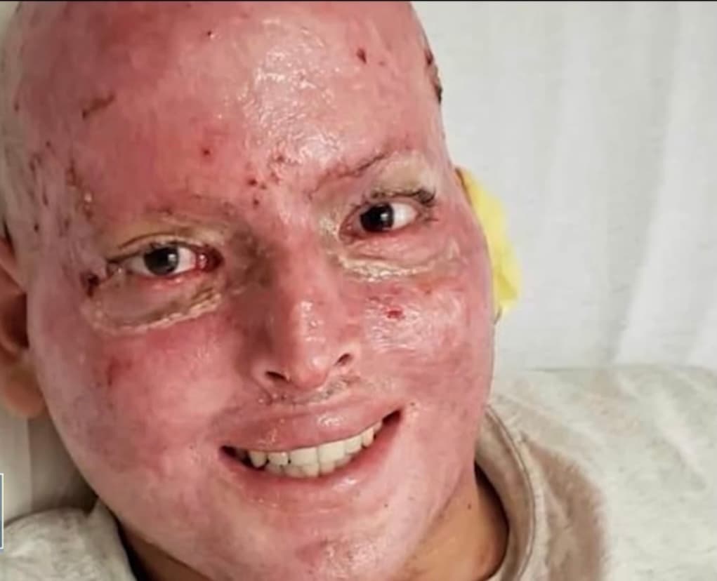 A pesar de la desesperación que siente todos los días, Alexis asegura que no pretende pedirle dinero a nadie. 
<b>“No quiero donaciones</b>, quiero que el gobierno estadounidense tome acciones y resuelva mi caso”, finaliza Hernández. 
<br>