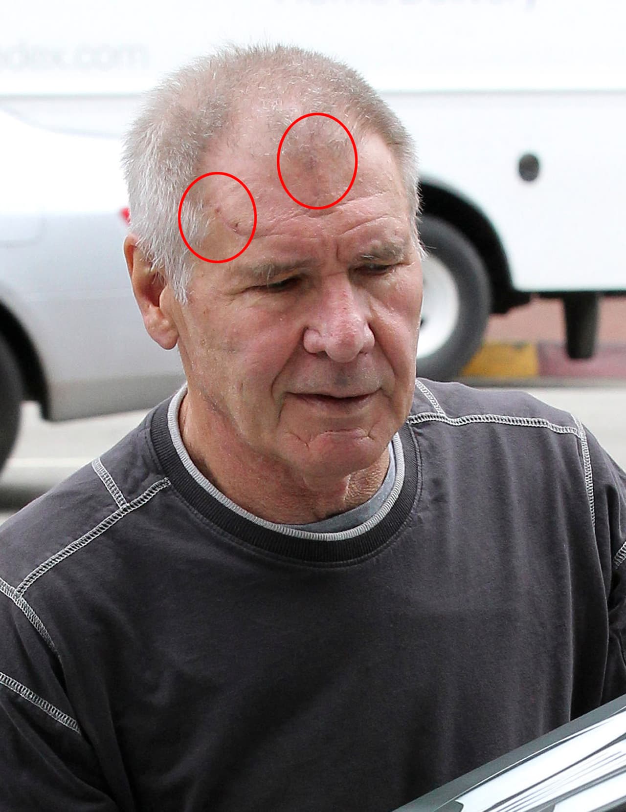 Ahora aparece recuperado y sólo con un par de cicatrices.