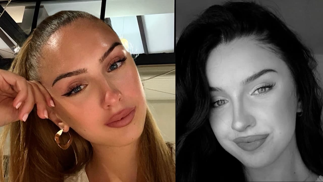 Muere reina de belleza tras haberse sometido a siete cirugías: tenía 22 años