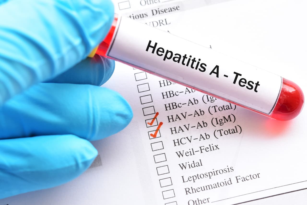 <b>Puesto 27. Hepatitis: 0.22%. </b>126,391 muertes en 2017. Según el estudio, las causas de muerte varían significativamente de un país a otro: las enfermedades no transmisibles dominan en los países ricos, mientras que las enfermedades infecciosas siguen siendo altas en las naciones con ingresos bajos.