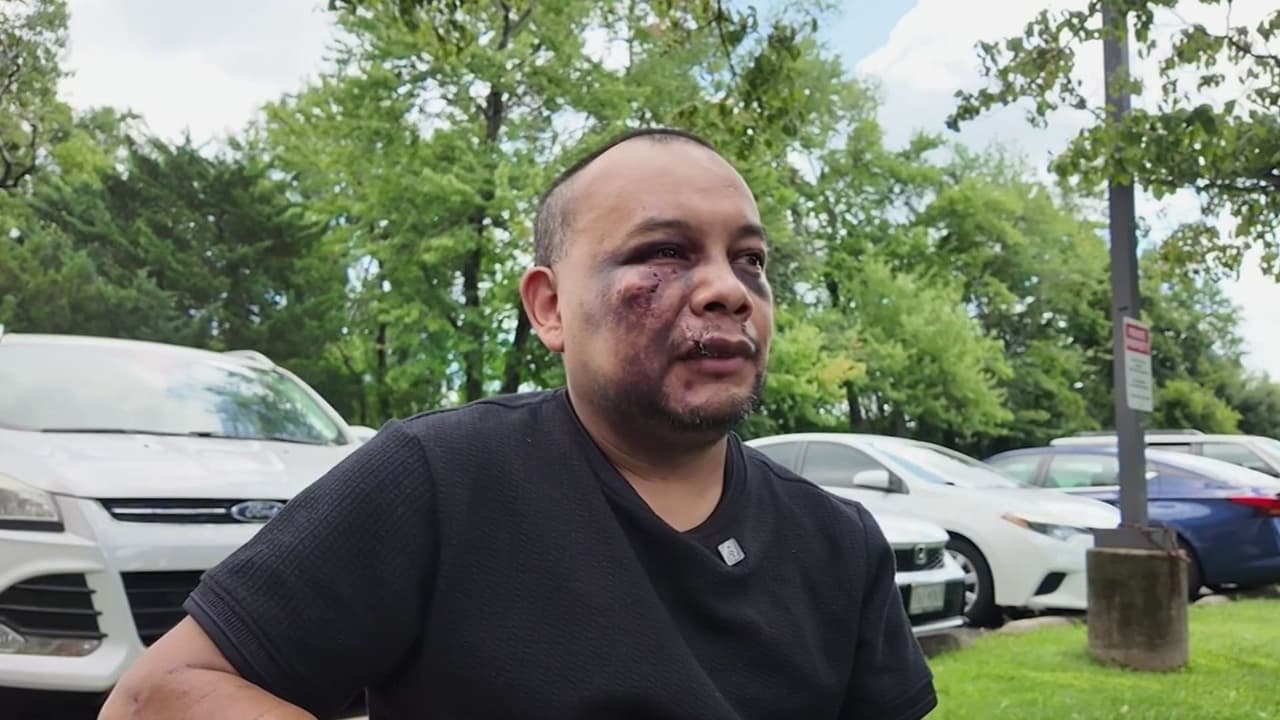 "Me siento temeroso": Inmigrante termina hospitalizado tras operativo de ICE; acusa que recibió una descarga eléctrica