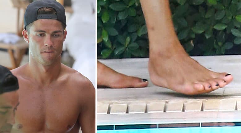 Cristiano tenía esmalte negro en las uñas de los pies.