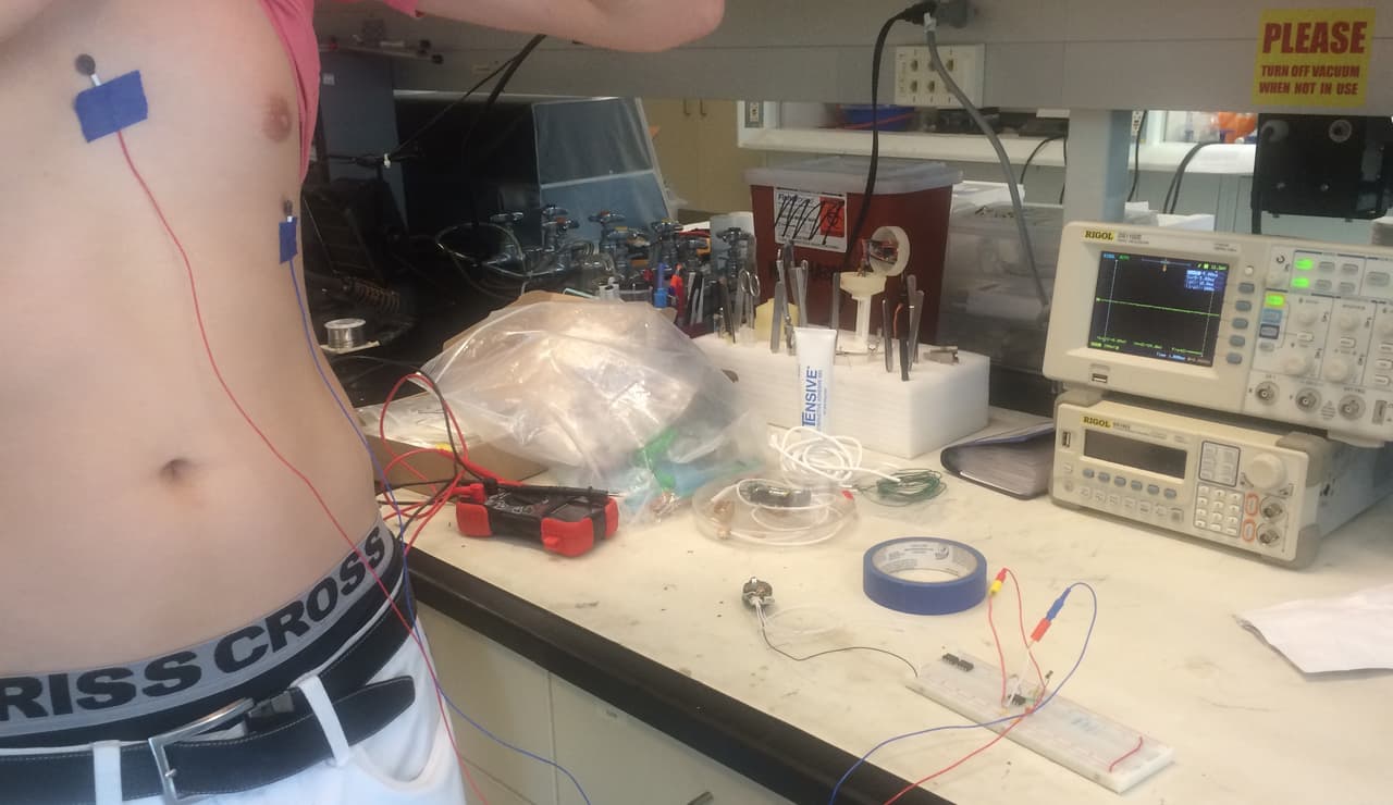 Prototipo para pacientes epilépticos creado en el programa ENLACE de UCSD.