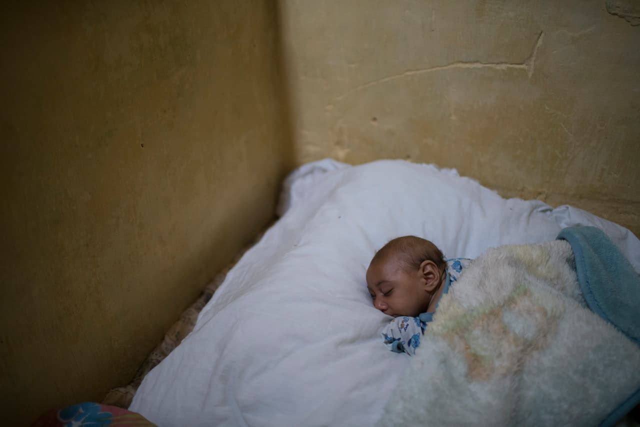 Brasil dijo que se han confirmado 508 casos de microcefalia, mientras que 3,935 aún están bajo investigación.