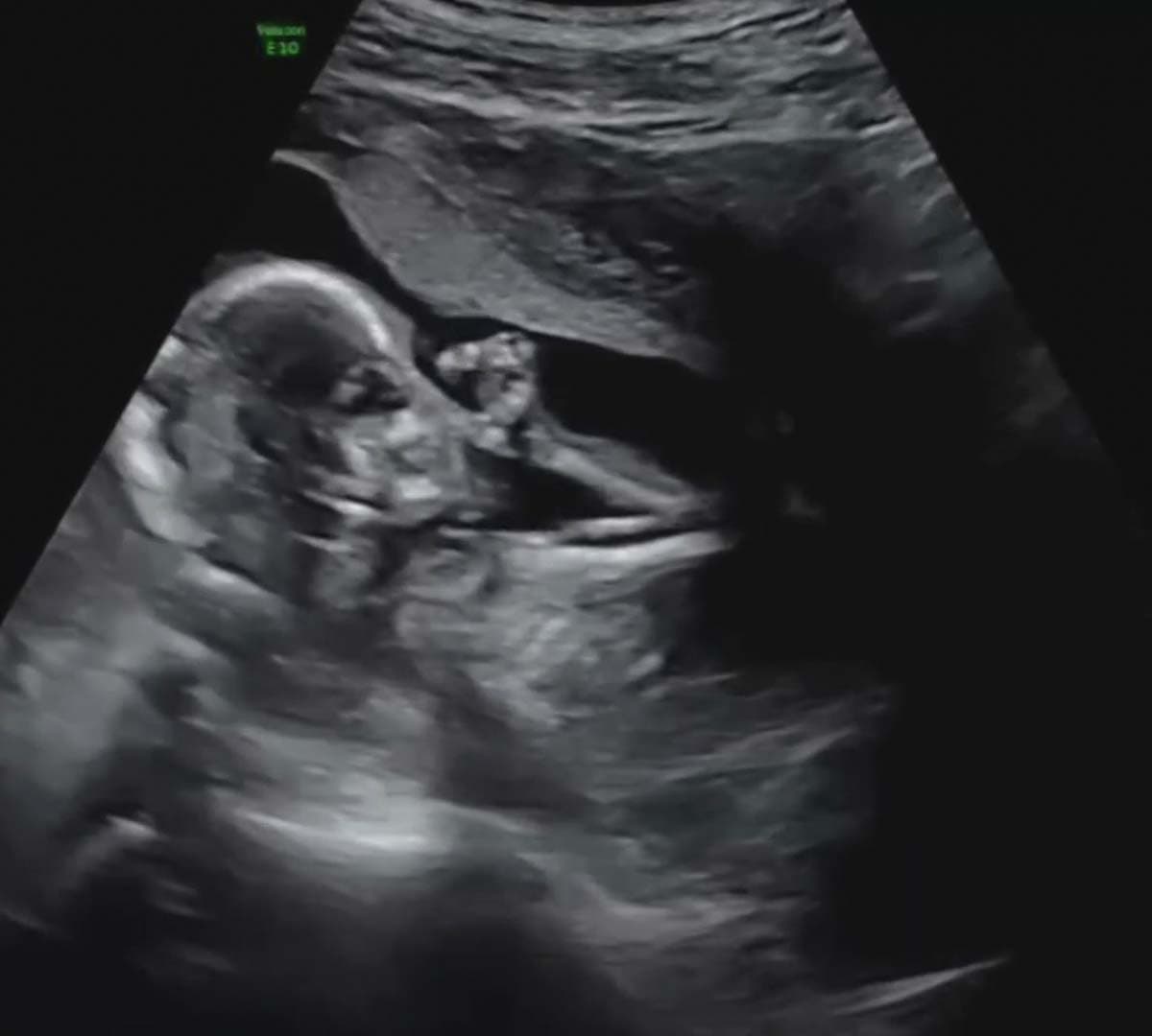 "Me han preguntado mucho 
<b>si he tenido síntomas</b>", escribió la comunicadora a través de Instagram. 
<br>