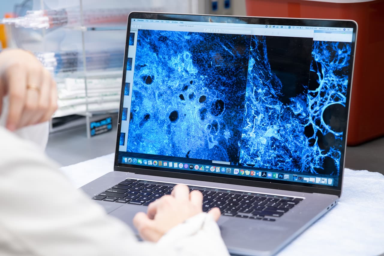 "Sus médicos nos dijeron que no podían hacer nada más por él", explica la sobrina de Aquino, Tasha Sundstrom. “Luego, vi una noticia sobre trasplantes de pulmón que se estaban realizando en pacientes con covid-19 en Northwestern Medicine y se la mencioné a los médicos de mi tío. Llamaron al equipo de trasplante de pulmón y lloré de alegría cuando el tío Renato fue trasladado al Northwestern Memorial Hospital a principios de febrero”.
<br>