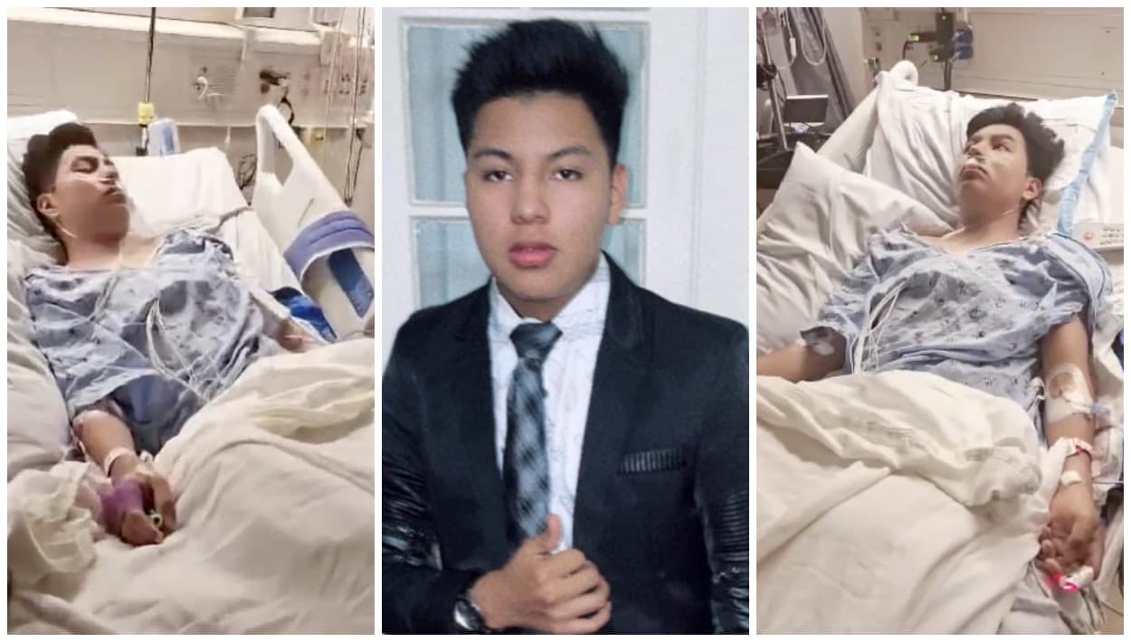 "Acaba de perder la pierna izquierda": huérfano de Guatemala atropellado en Santa Mónica