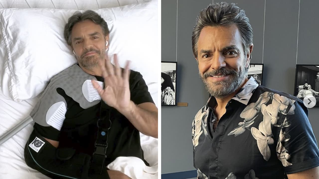Eugenio Derbez revela cuándo podría regresar el movimiento en su brazo tras su cirugía de hombro