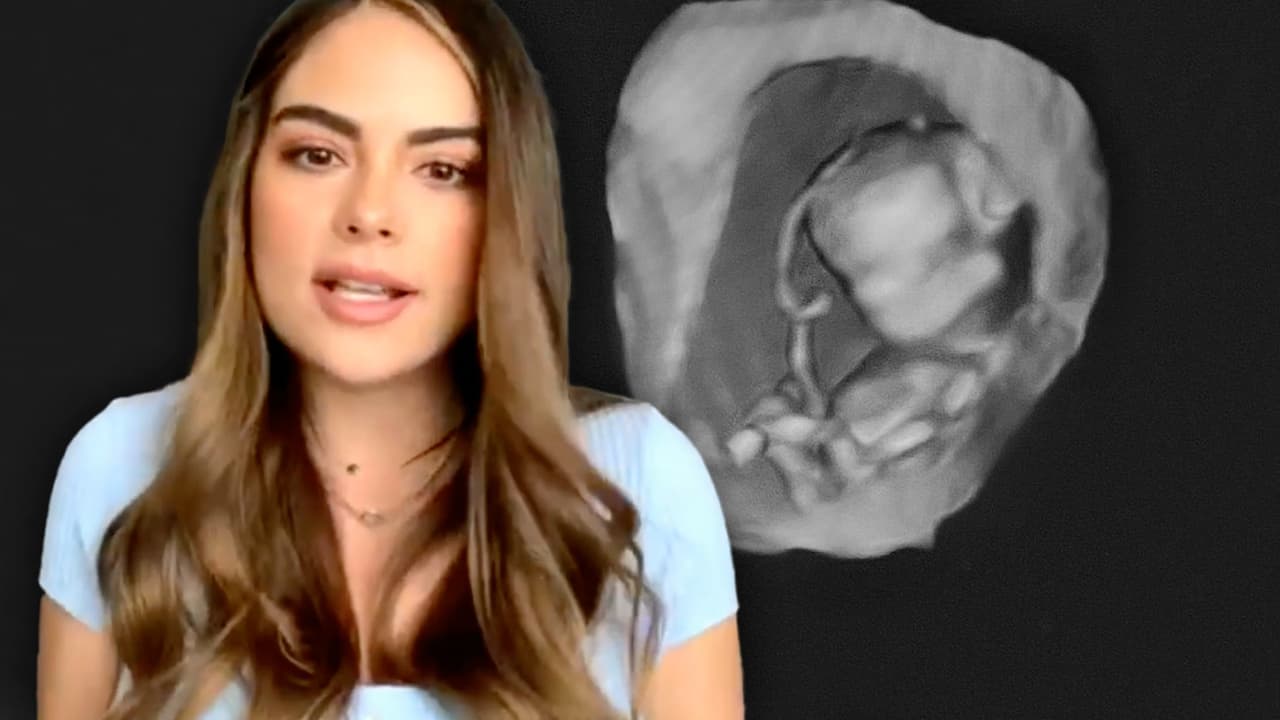 Ximena Navarrete comparte la "malformación genética" que tenía su bebé y por la cual lo perdió