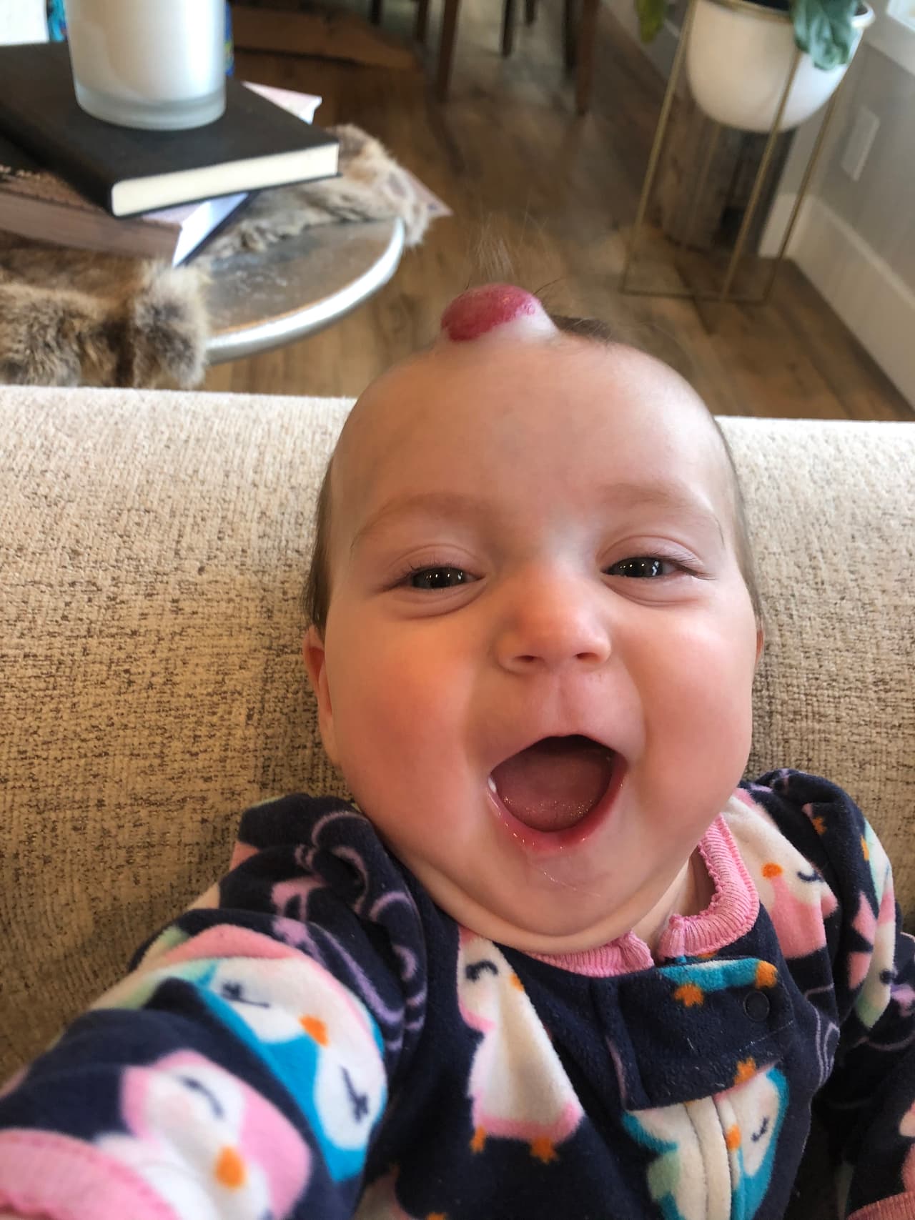 Sin embargo, en otros casos como el de Chloe no es así: el de ella fue aumentando de tamaño bastante rápido.