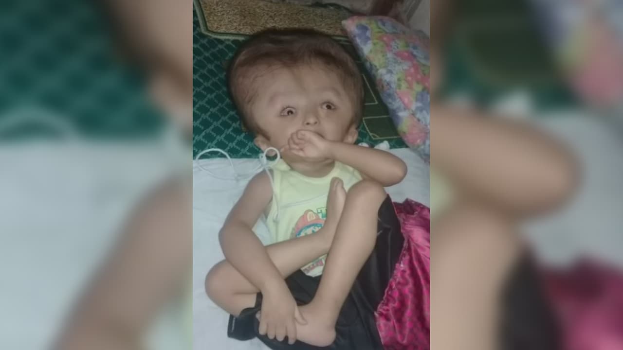 <b>Muere Abraham de Jesús, el niño con hidrocefalia que luchaba por su vida</b>
<br> 
<br>El pequeño, de 6 años, sufría de hidrocefalia y los escasos recursos con que contaba su familia impedía que pudieran tener la ayuda que necesitaba. 
<br>
<br>Gracias al apoyo de los televidentes el menor fue sometido a una cirugía en la que le cambiaron una válvula para que su cabeza se redujera permitiendo que pudiera tener más esperanza de vida. Sin embargo, no pudo soportar más y murió.