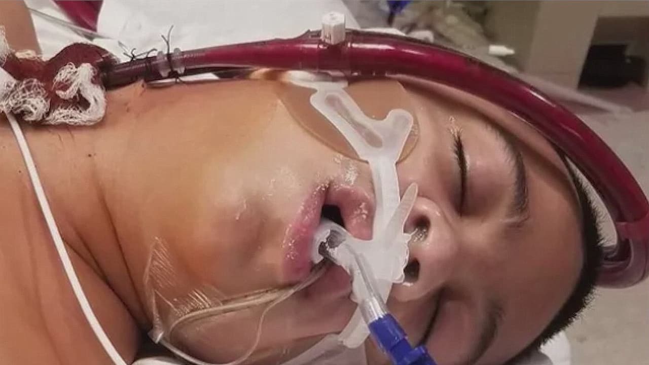 Un niño de 13 años termina en el hospital tras ser obligado a fumar un vaporizador con fentanilo