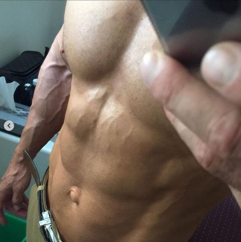 Entró a quirófano para que le fuera operada una "hernia umbilical": "Es importante operarse a tiempo, esto es muy común en los que hacemos ejercicio y cargamos algo de peso, esto puede provocar una peritonitis y
<b><a href="https://www.instagram.com/p/CRFGlvvB5-I/?utm_source=ig_embed&ig_rid=19df2c48-3632-4f6f-8454-68c6bdfc2e4c" target="_blank"> podría estar en riesgo tu vida</a></b>", escribió en Instagram en junio pasado.
<br>