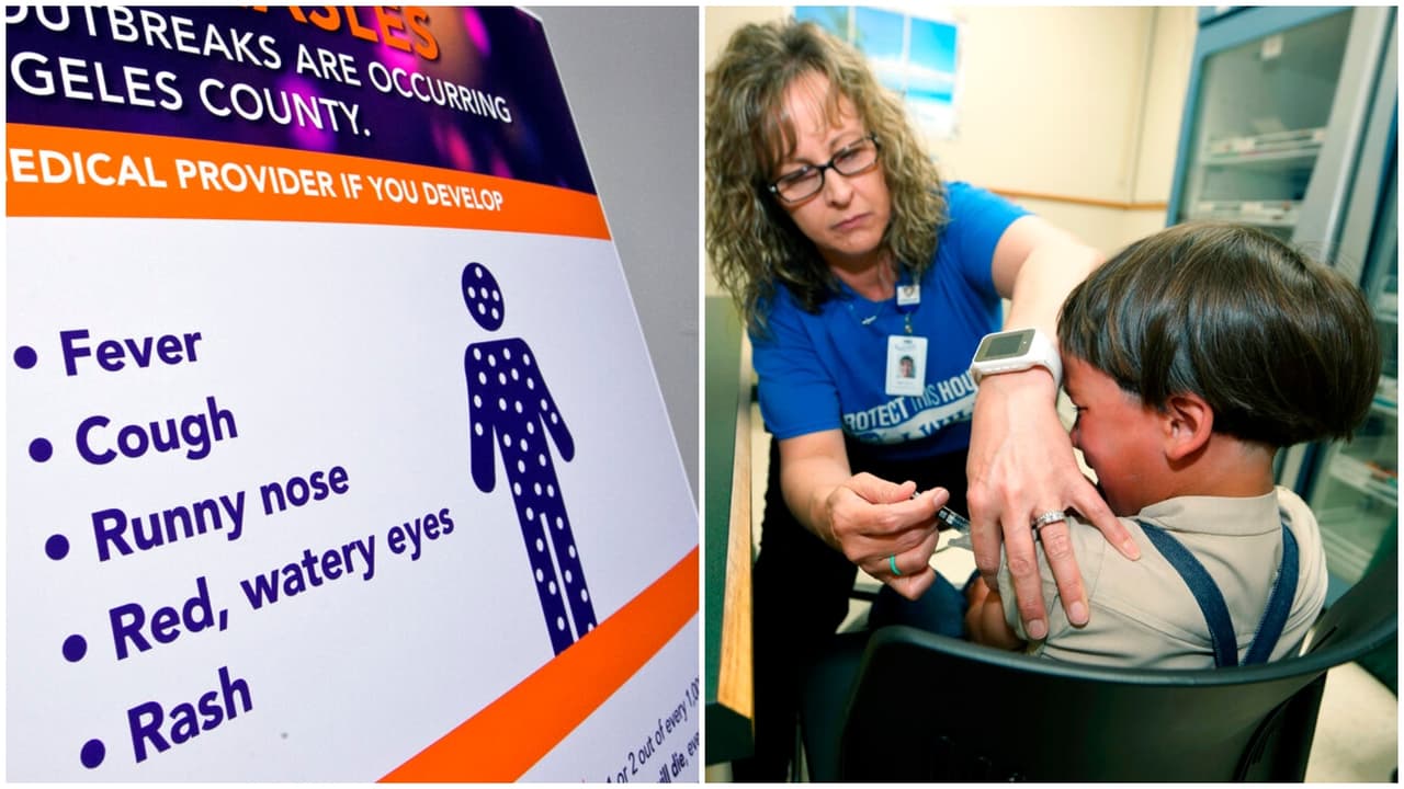 Sarampión, el riesgo más allá de la infección del que poco se sabe y es más grave de lo que se cree
