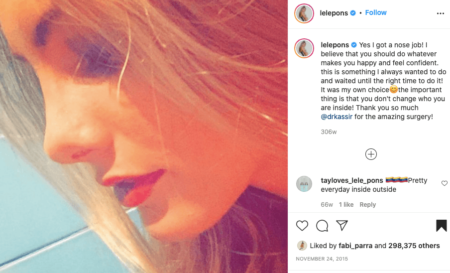 Lele Pons no teme compartir videos y fotografías de su transformación. En 2015 contó a través de una publicación de Instagram que lo hizo para sentirse feliz y segura. “Es algo que siempre quise hacer y esperé hasta el momento correcto para hacerlo… Lo importante es que no cambia quién eres por dentro”.