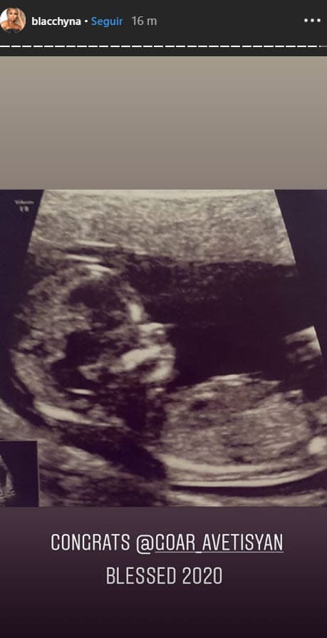 La exbailarina volvió a publicar la imagen, pero ahora en sus historias de Instagram, etiquetando 
<b>a Goar Avetisyan</b>, quien es la dueña del ultrasonido.