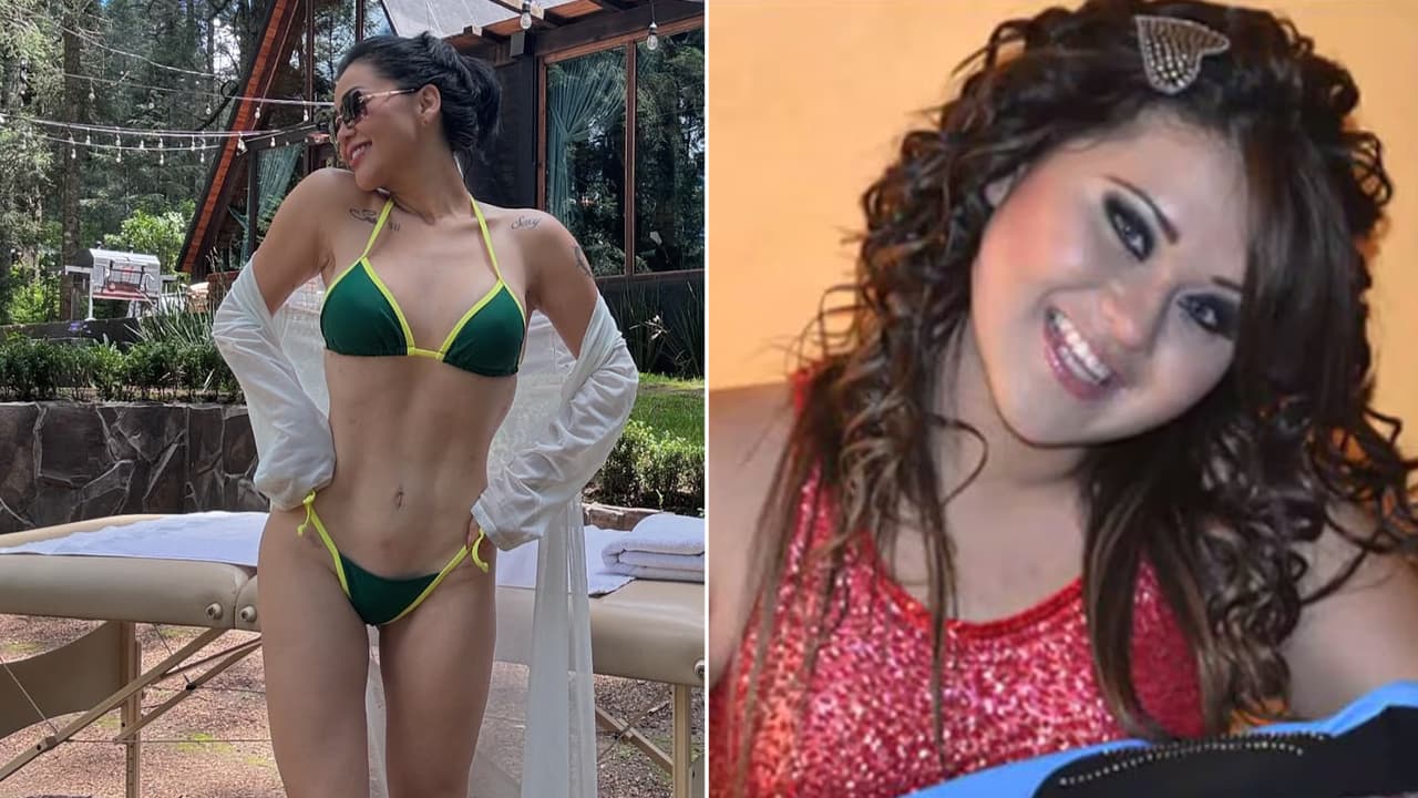 ‘Gomita’ responde si sufre trastorno alimenticio tras "15 cirugías” y drástico cambio físico