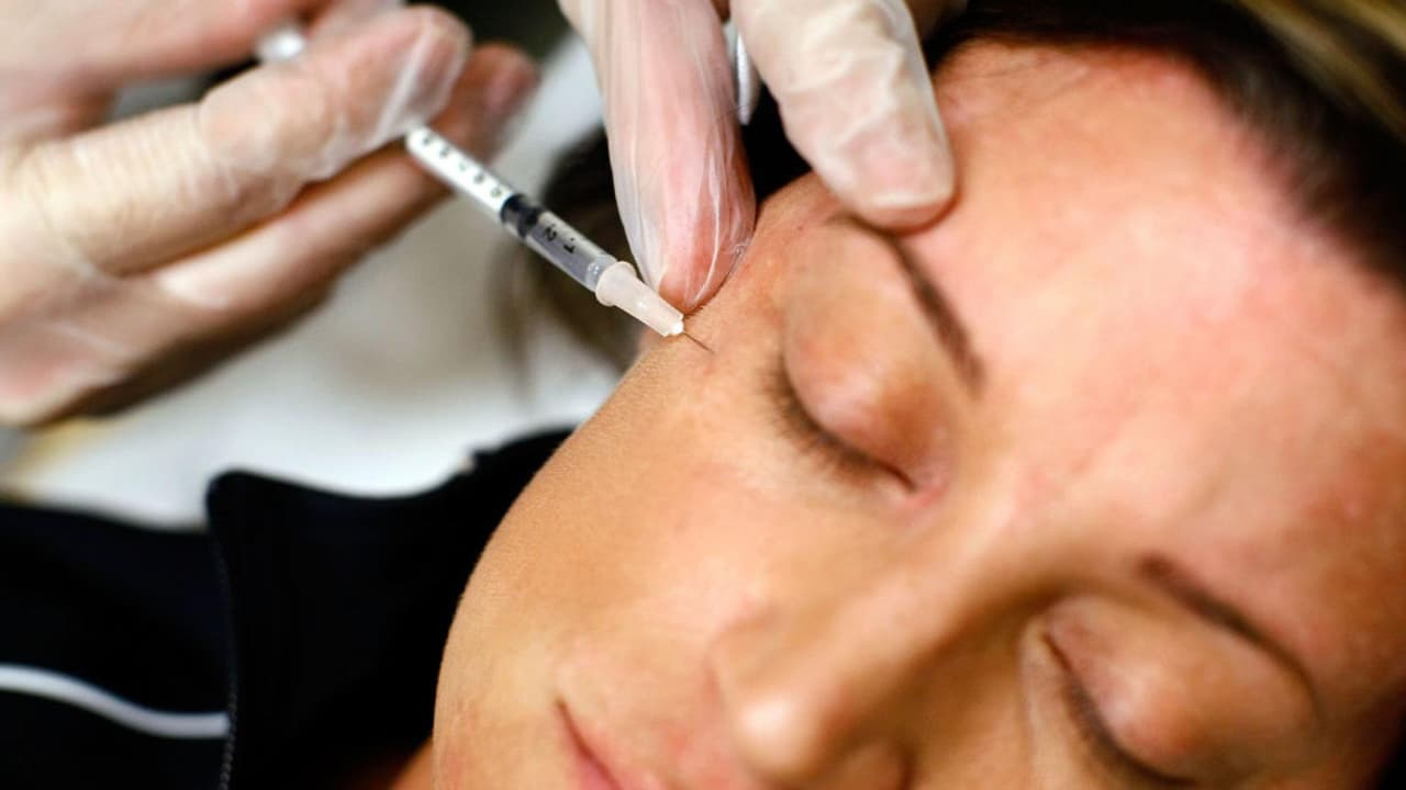 ¿Es aconsejable aplicarse botox antes de los 30 años? Un experto responde todas tus dudas