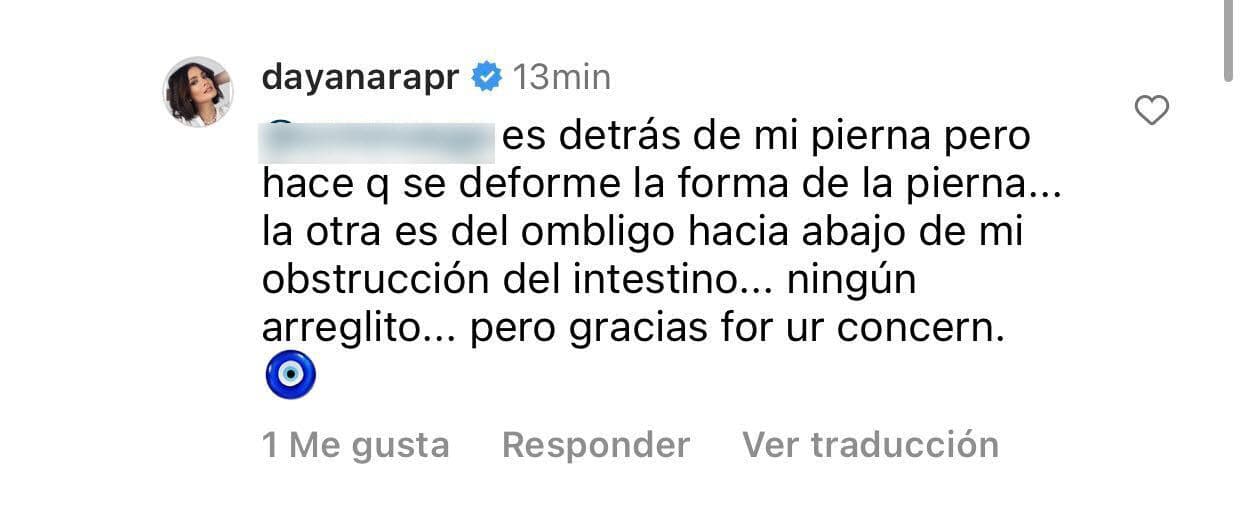 Dayanara Torres le explicó que la otra operación a la que se sometió mientras tuvo cáncer le dejó una cicatriz por donde está el ombligo "abajo de mi obstrucción de mi intestino": 
<b>"Ningún arreglito"</b>, advirtió. 
<br>