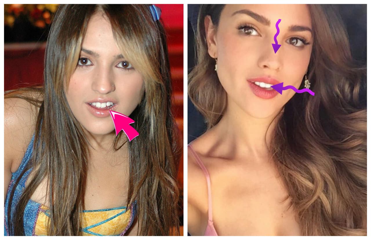 Eiza pasó de ser una niña con nariz grande, a un rostro divino y afilado.