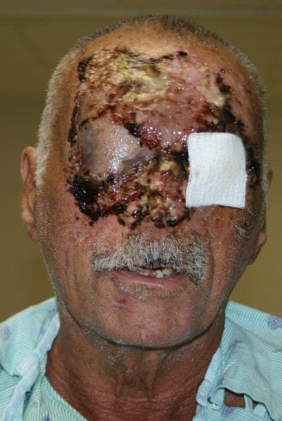 Su vida estaba en peligro sin embargo con los cuidados médicos en estos meses se ha recuperado satisfactoriamente.