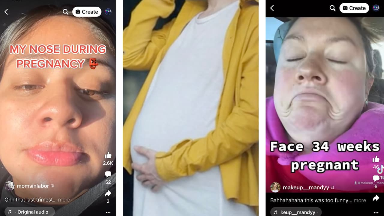 ¿Te ha crecido la nariz durante el embarazo?: Un experto explica qué es la rinitis gestacional y si es peligrosa