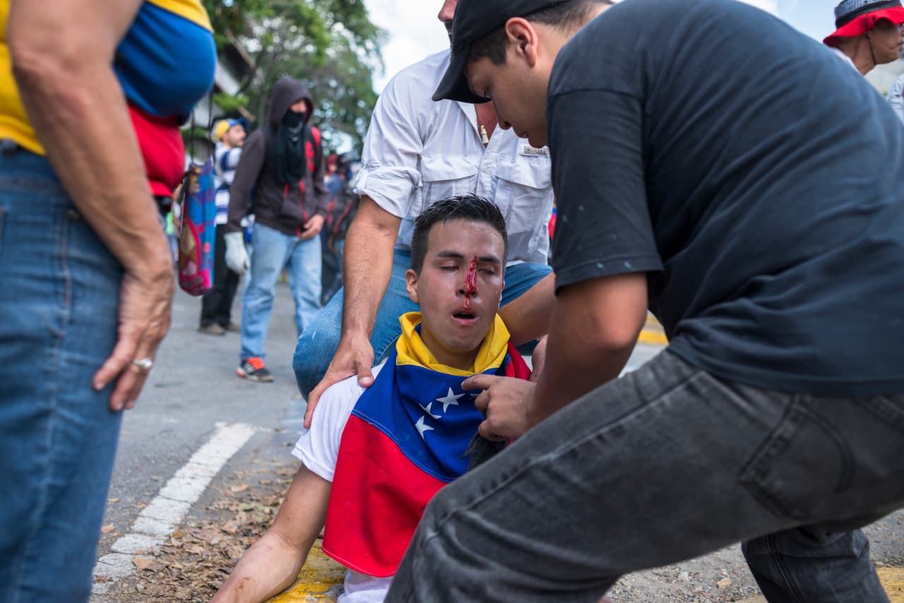 Un activista opositor resultó herido en el rostro durante el combate con la policía. Caracas, 8 de abril de 2017.