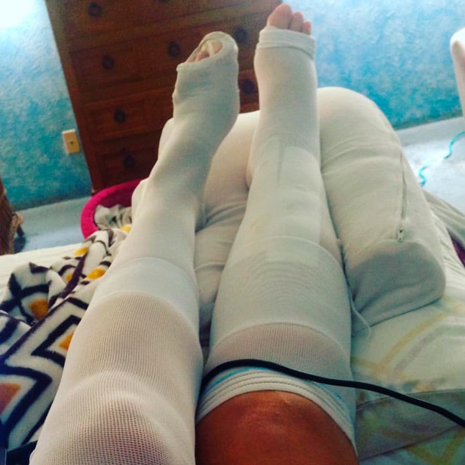 Después de la operación.