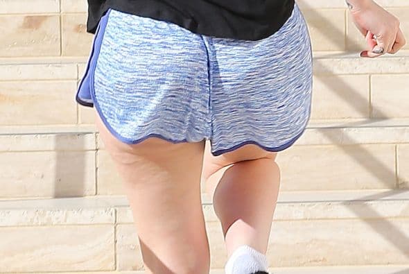 La joven rapera tiene unas tremendas caderas y tal vez le hace más complicado lidiar con este mal.