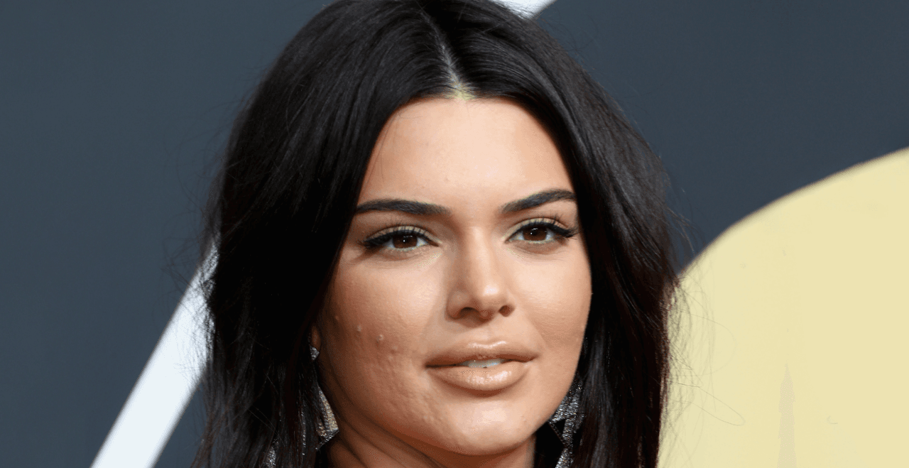 Kendall Jenner muestra sus cicatrices de acné sin complejos y anima a otros jóvenes a hacerlo
