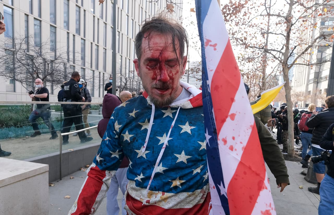 Varias personas resultaron heridas, pero aún se desconoce si sufrieron lesiones graves.