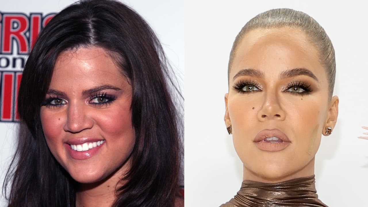 Khloé Kardashian, el antes y el después: las cirugías y procedimientos a los que se ha sometido