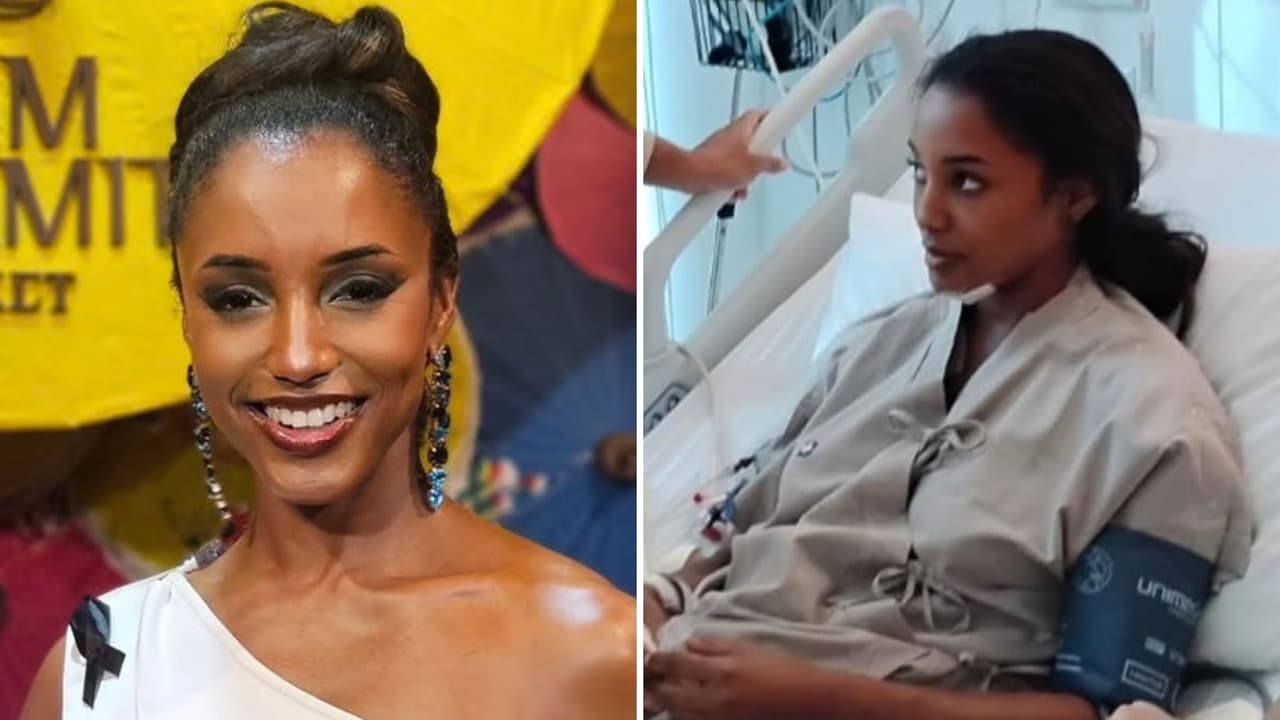 Gabrielle Henry, Miss Jamaica, comparte fotos inéditas de las lesiones que sufrió tras caída en Miss Universe
