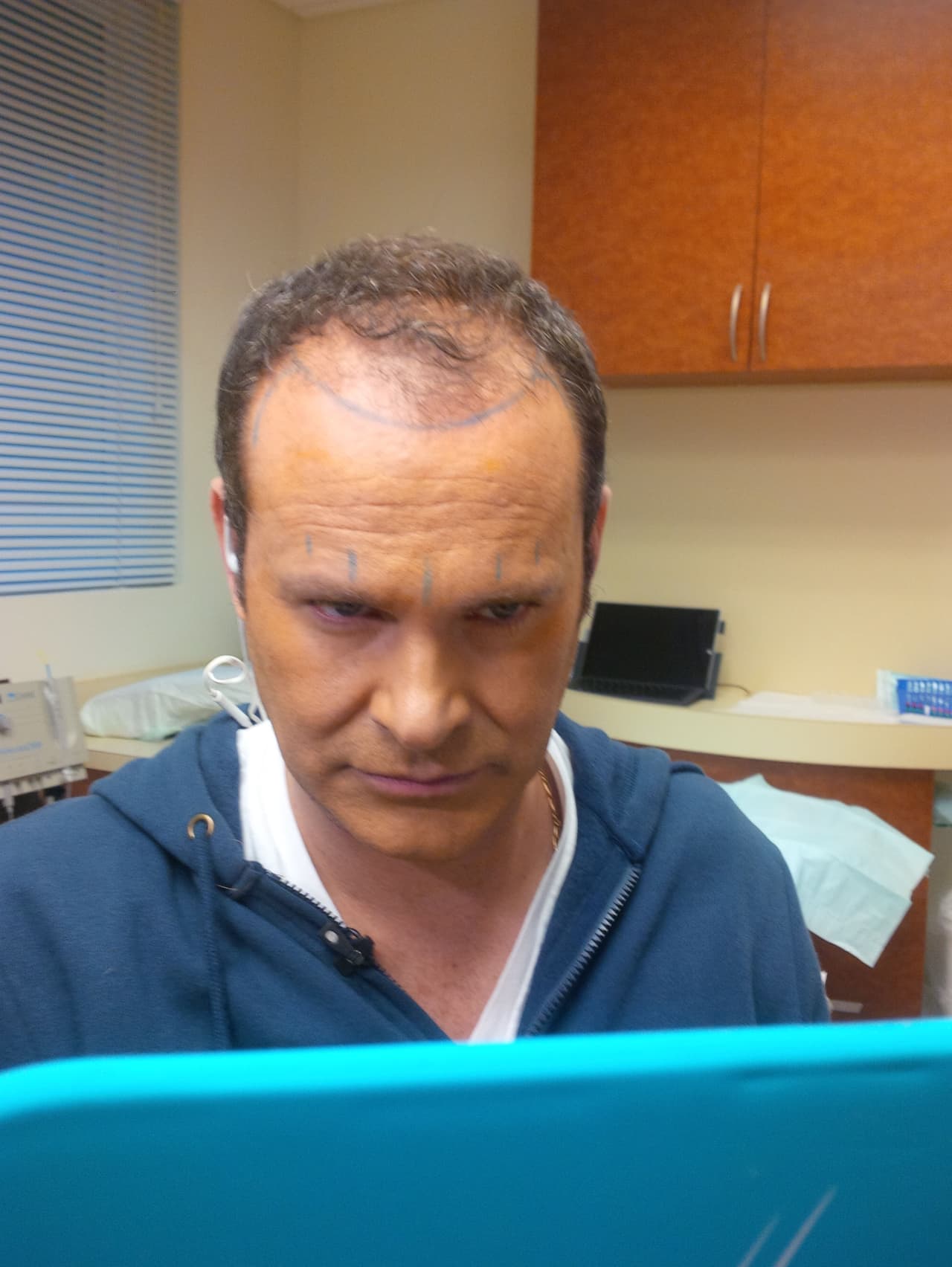 "Estuve aproximadamente 3-4 horas más ahí porque es cabello por cabello y la verdad que el proceso ha sido maravilloso", afirmó Alan.