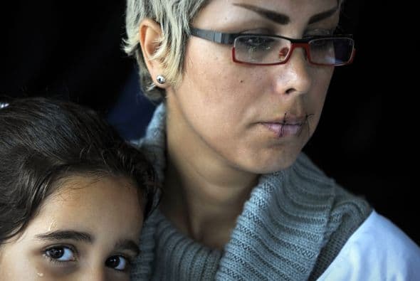 De ellos, una mujer periodista y siete hombres se cosieron la boca, dijo el grupo de izquierda 'Unión contra el racismo y la amenaza fascista' que los apoya.