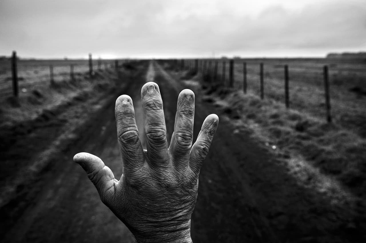 La mano con las uñas quemadas de Alfredo Cerán, quien trabajó durante nueve años aplicando agroquímicos en campos de soya. Los análisis de su sangre registraron residuos de glifosato y otros químicos tóxicos. Monte Maiz, provincia de Córdoba.