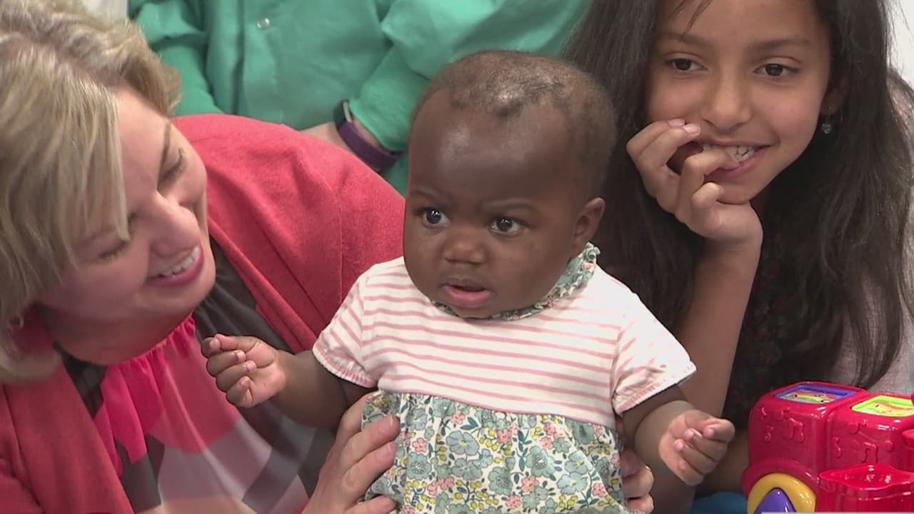 Médicos de Chicago operan con éxito a una menor que nació con cuatro piernas y dos columnas vertebrales