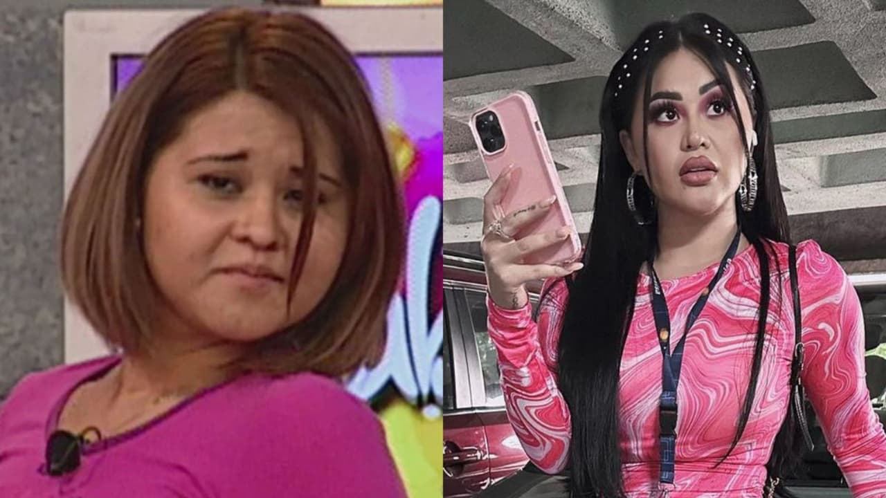 Gomita y su impresionante transformación: de ser payasita en ‘Sabadazo’ a su última cirugía