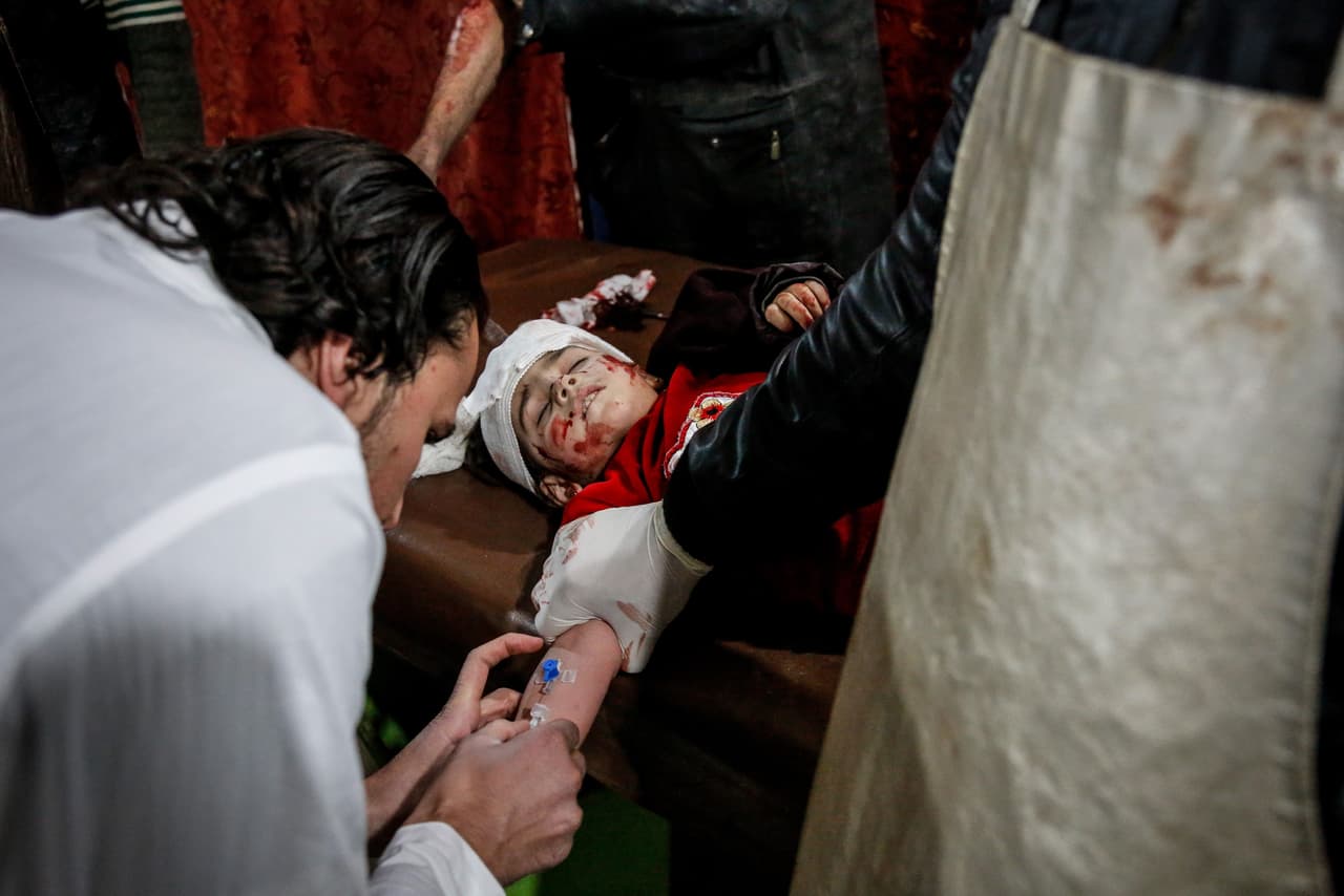Un niño recibe tratamiento médico después de que aviones de guerra del régimen de Assad llevaron a cabo ataques aéreos en zonas residenciales de Kafr Batna, Guta Oriental, el 18 de marzo. Según el Observatorio Sirio para los Derechos Humanos, aviones rusos han participado en los ataques.