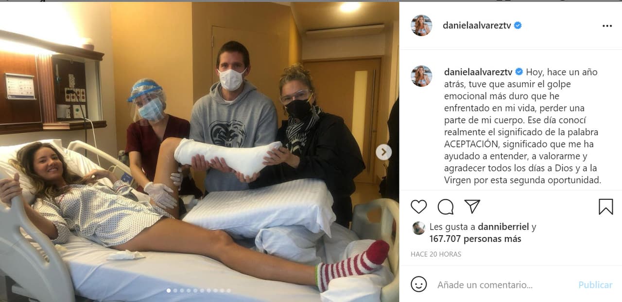 "Hace un año atrás, tuve que asumir el golpe emocional más duro que he enfrentado en mi vida: 
<b><a href="https://www.instagram.com/p/CQEchbCpKwJ/" target="_blank">perder una parte de mi cuerpo</a></b>", escribió este domingo 13 con una serie de fotos de aquel día.
<br>