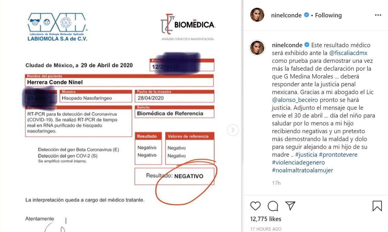 El pasado 2 de mayo 
<b><a href="https://www.univision.com/famosos/ninel-conde-publica-que-dio-negativo-al-covid-19-y-nuevas-pruebas-contra-giovanni-medina-fotos">Ninel Conde</a></b> hizo públicos los resultados de la prueba de 
<b>covid-19</b> a la que se sometió, para demostrar que 
<b>está sana</b> y que el principal argumento de su expareja Giovanni Medina para no dejarla ver a su hijo no tiene fundamento.
<br>