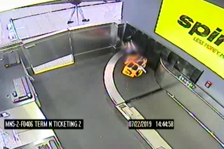 El agente de TSA dijo a los oficiales que el niño estaba "mal herido" y los oficiales de Atlanta notaron que la mano derecha del menor estaba "severamente hinchada y magullada".