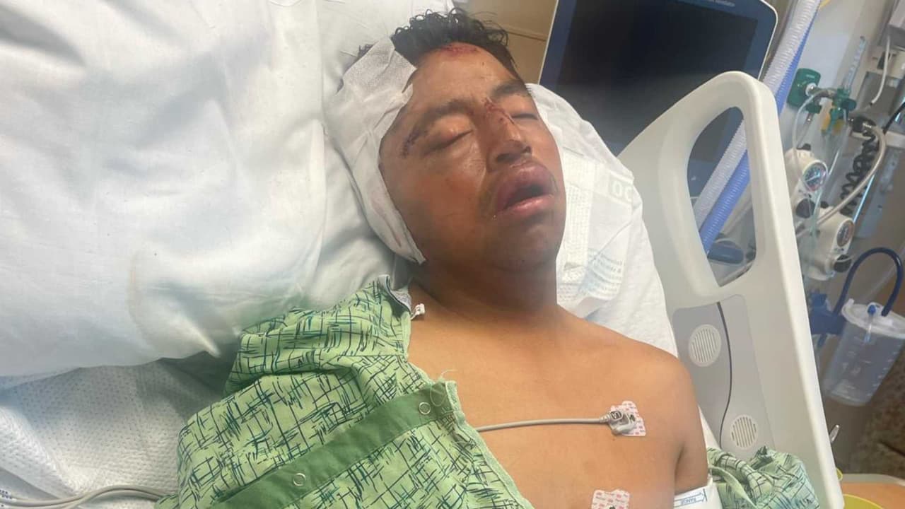 El ataque se produjo un día antes de la celebración del Día del Padre. La víctima, identificada como Modesto Hernández, fue abordada por dos hombres que le robaron sus pertenencias y lo dejaron gravemente herido.