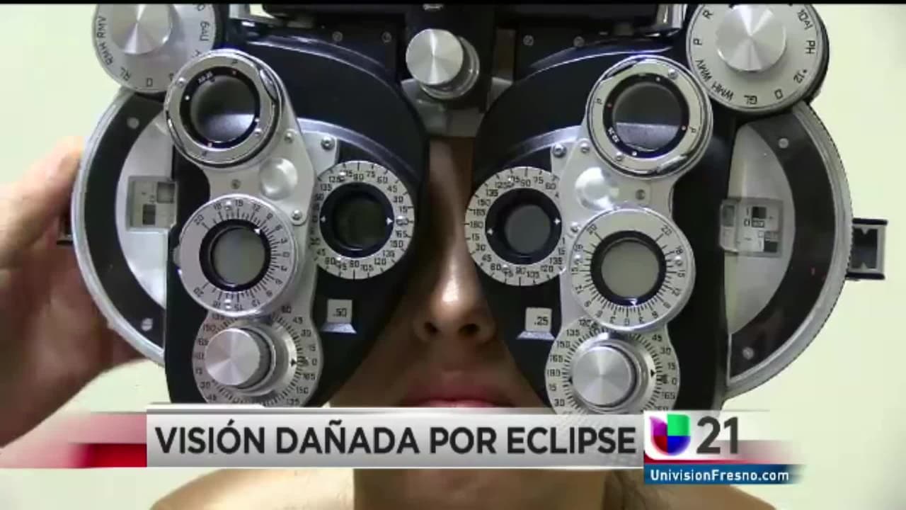 Los médicos ven un aumento en los pacientes un día después del eclipse