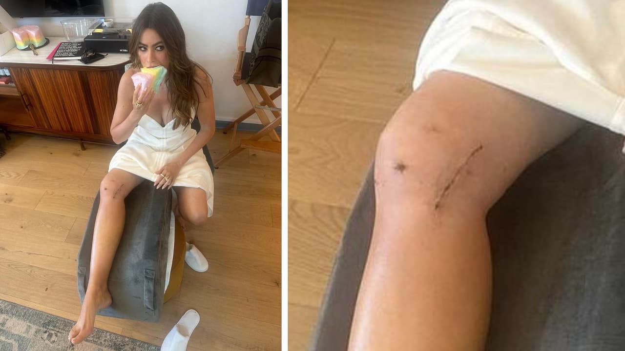 Sofía Vergara mostró la cicatriz en su rodilla.