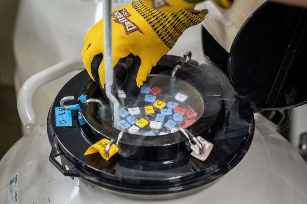 Fotografía de archivo del 28 de septiembre de 2022 que muestra a un miembro del personal sacando esperma de un donante del almacenamiento en el Hospital Universitario de Keio en Tokio, Japón.